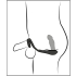 RC Vibrating Prostate Plug Nod
